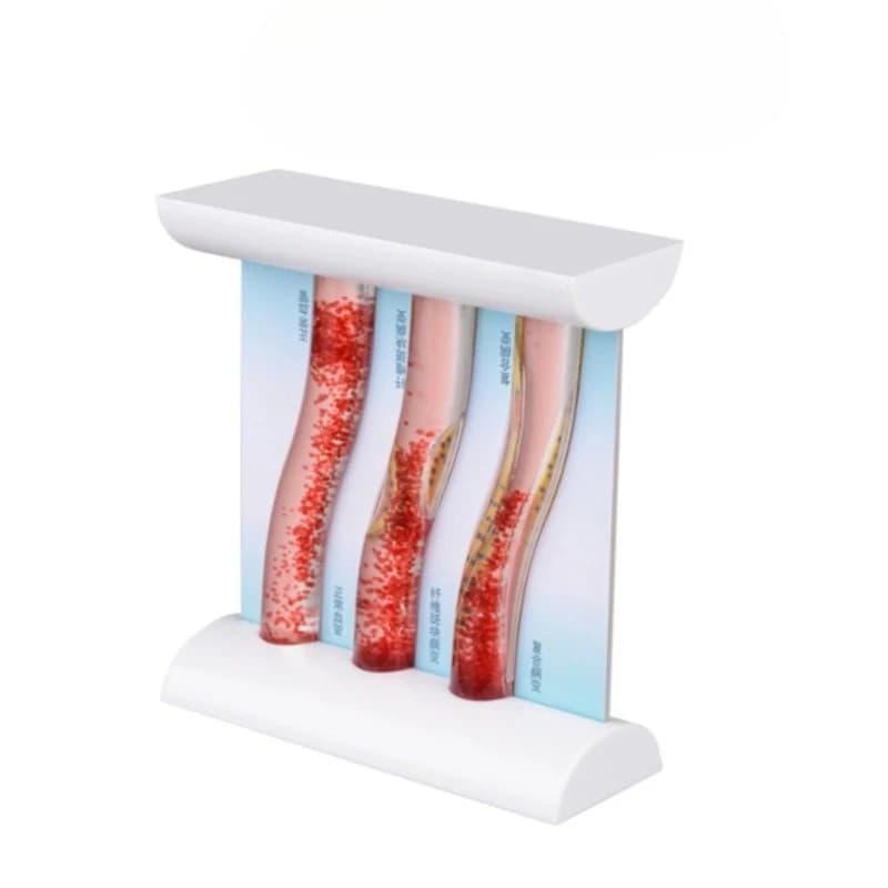Contrast of vascular consistency blockage, showing a dynamic vascular model simulated by a die
