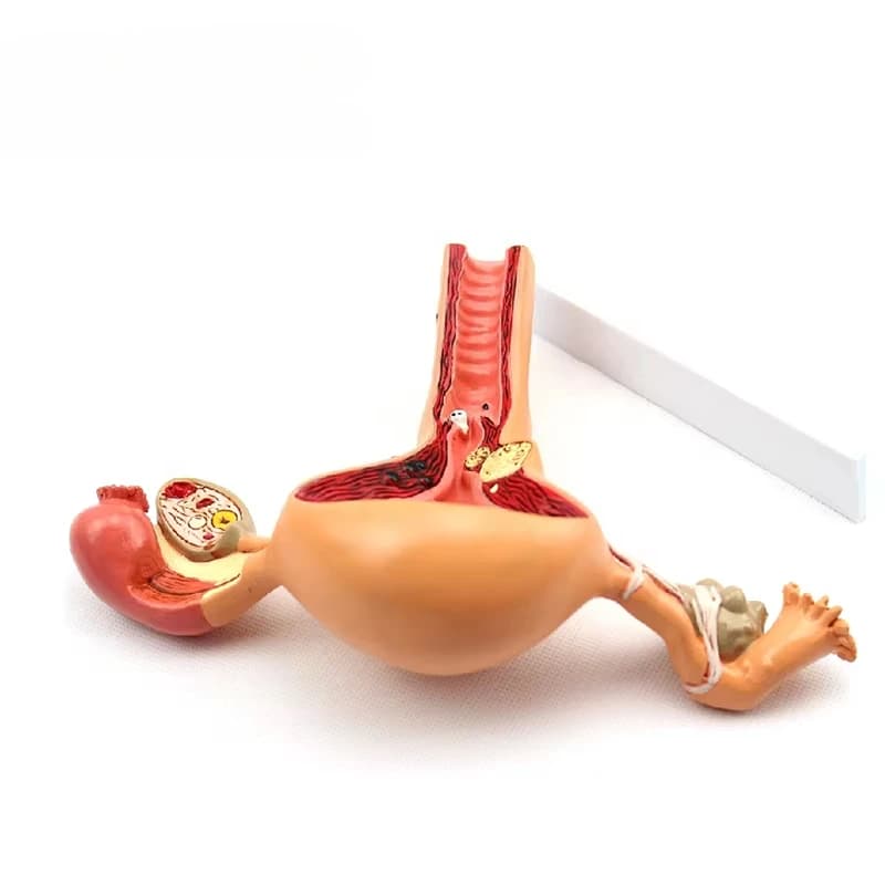 High-quality hot-selling diseased uterus models