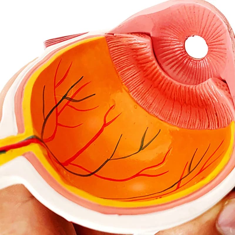 Medical Teaching Human Eye Cataract Anatomical Model