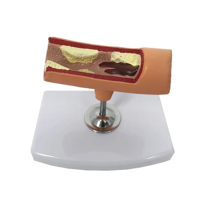 High-quality hot-selling teaching artery model