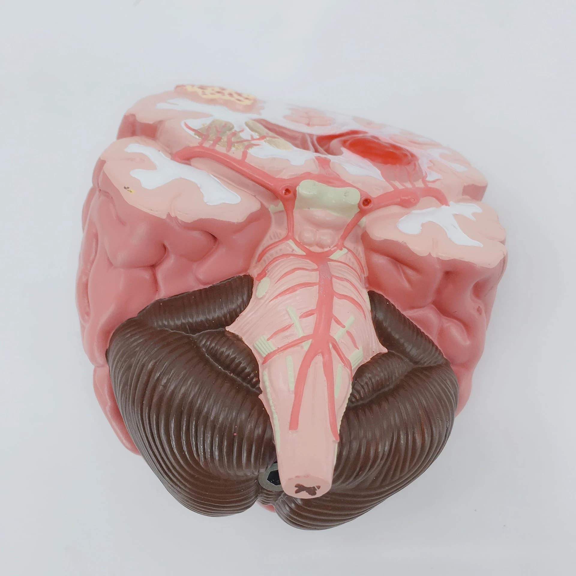 Simulated human brain disease model Brain structure anatomy teaching model