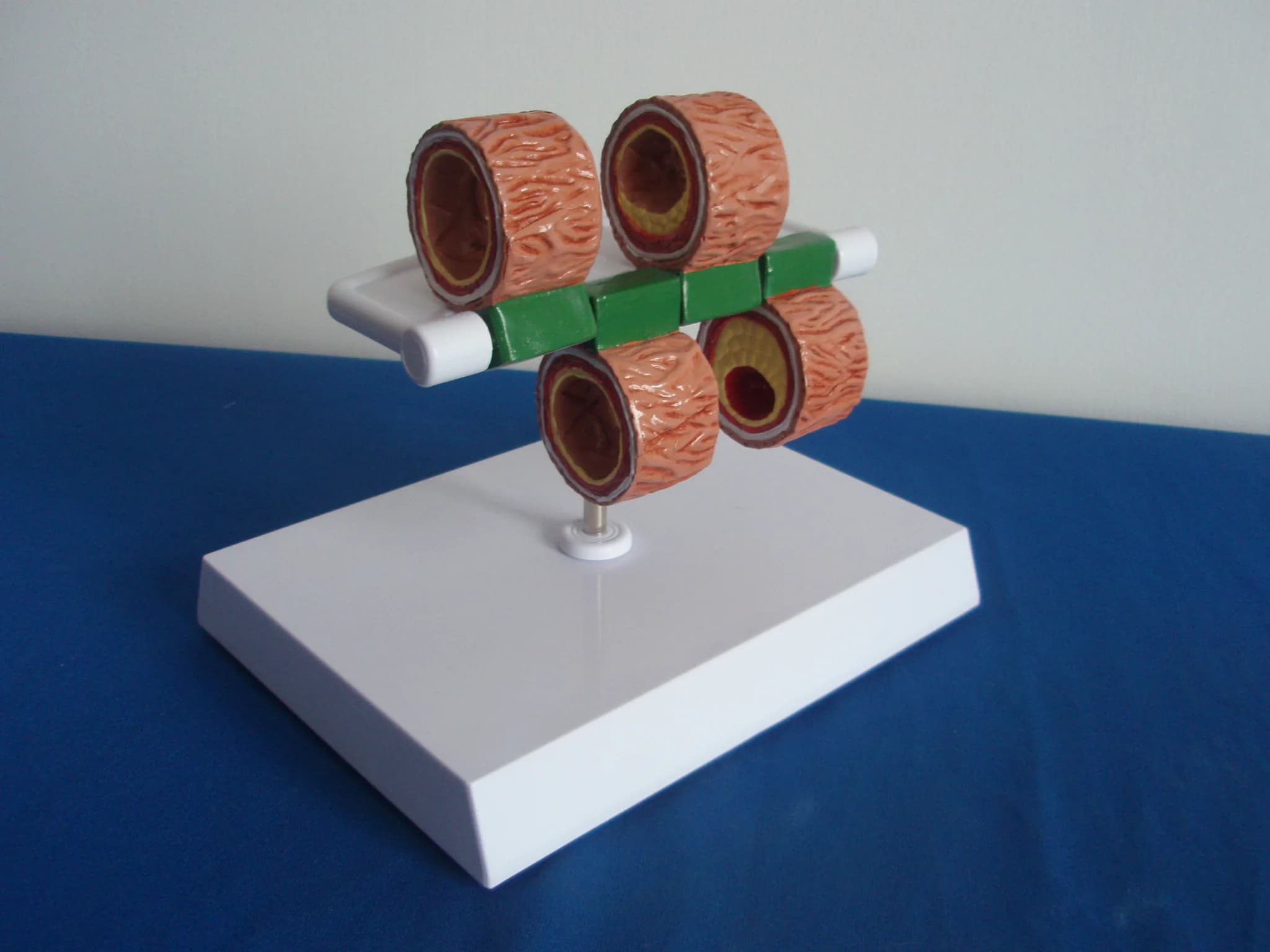 Medical Human Vascular Anatomy Model Organ Vascular Evolution and Sclerosis Anatomy