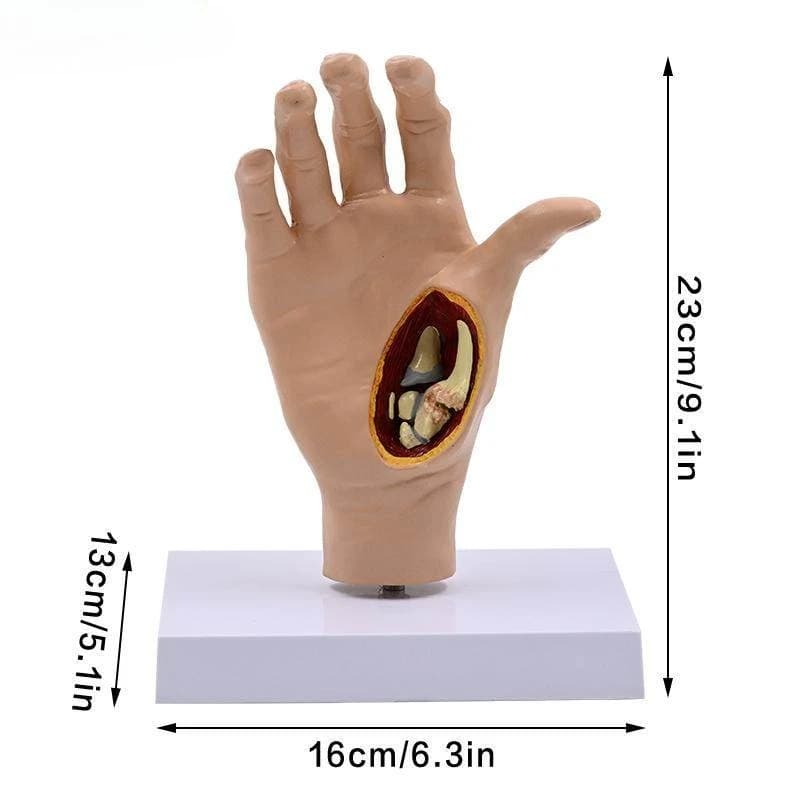 Hand tendons, ligaments, muscle anatomy teaching aids, pathological deformities, hand bones