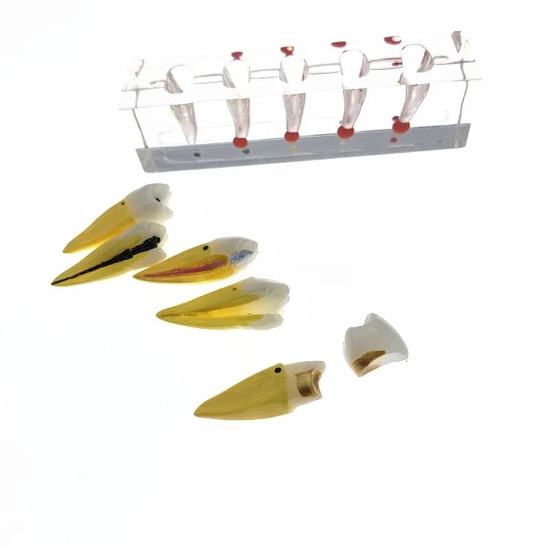 Dentals Endodontic Treatment Model Dentals Study Teach Teeth Model