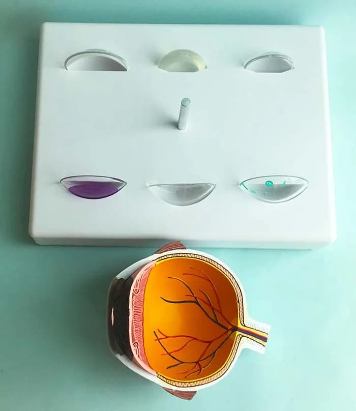 Glaucoma eye model eye chip/iris anatomy model eye structure model