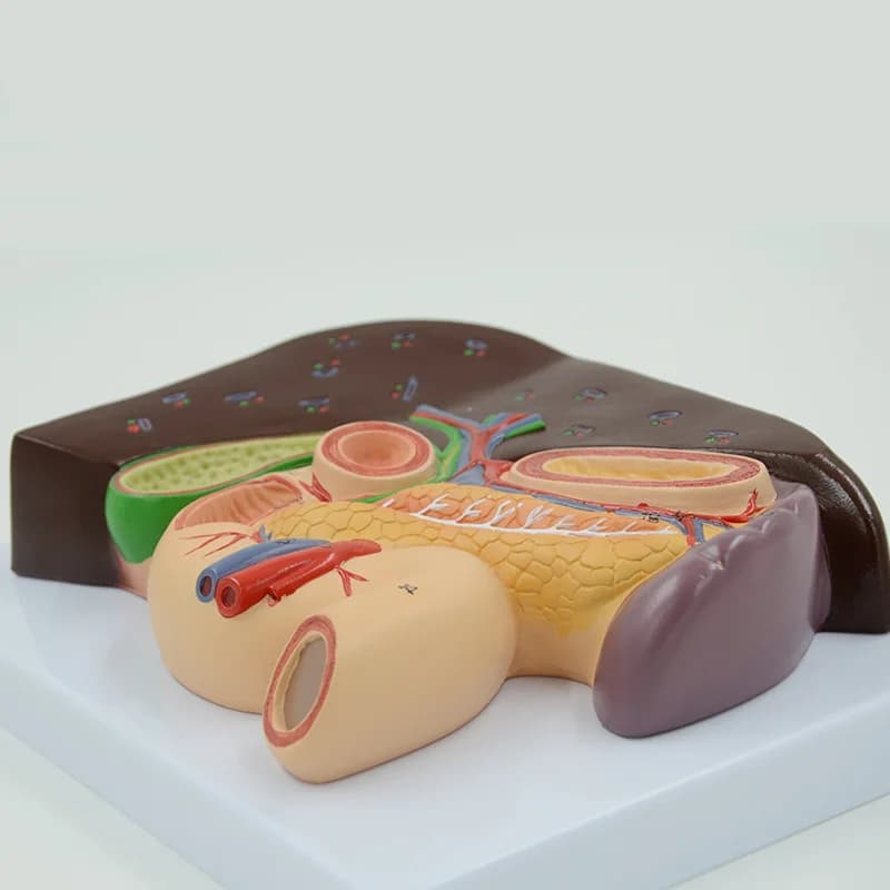 Human pancreas, liver, duodenum, gallstones, spleen, liver and gallbladder anatomical model teaching