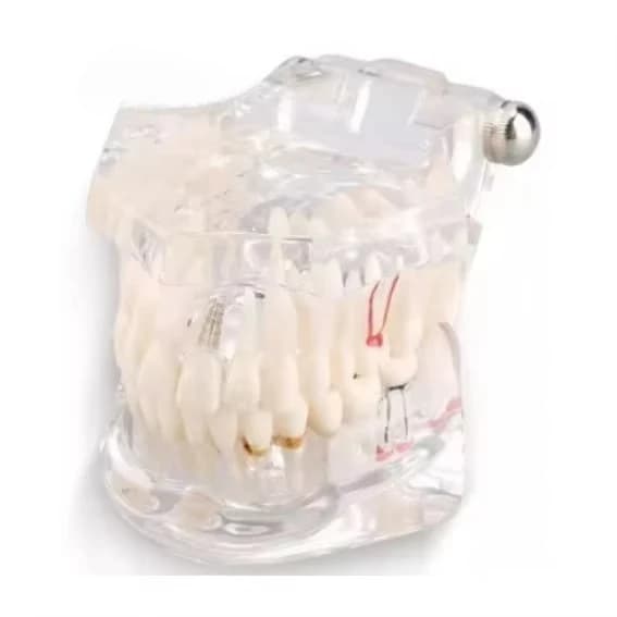 Dentals Model Dentals Materials Doctor-Patient Communication Model