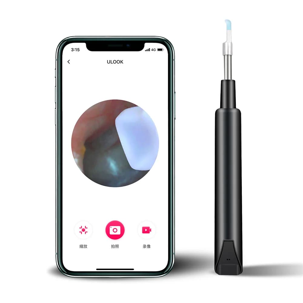 Factory Direct Price Visual Ear Picking Tool Wireless Ear Wax Re-moval  Otoscope High-definition  Ear Cleaning Tool