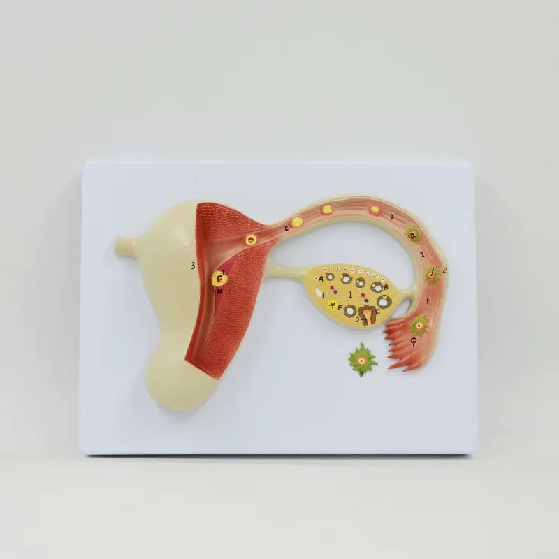 Enlargement model of human uterus and ovaries, teaching display mold