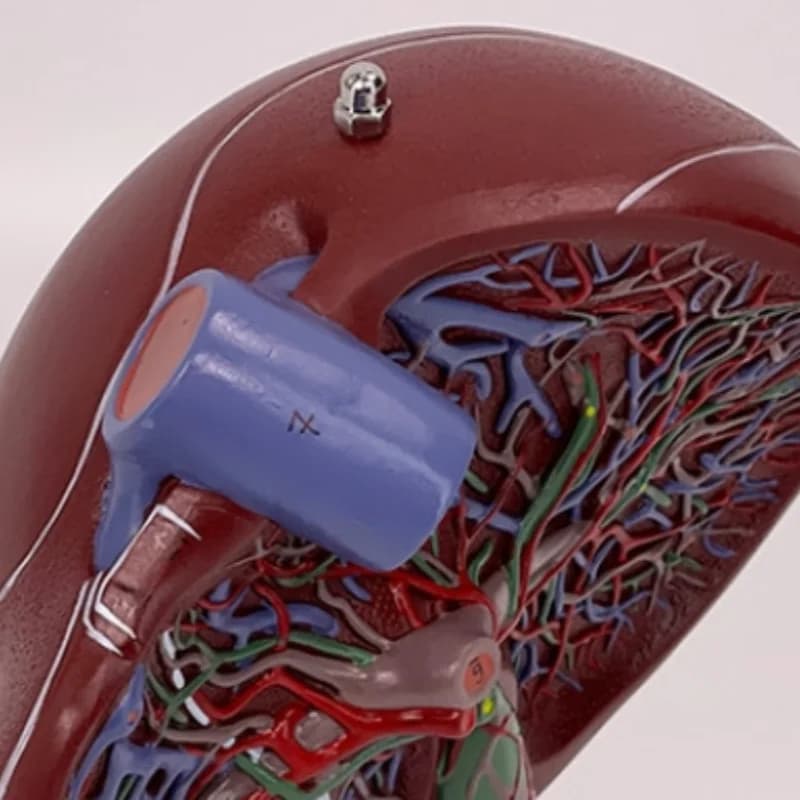 High-quality liver, pancreas, duodenum model, pancreatic structure model
