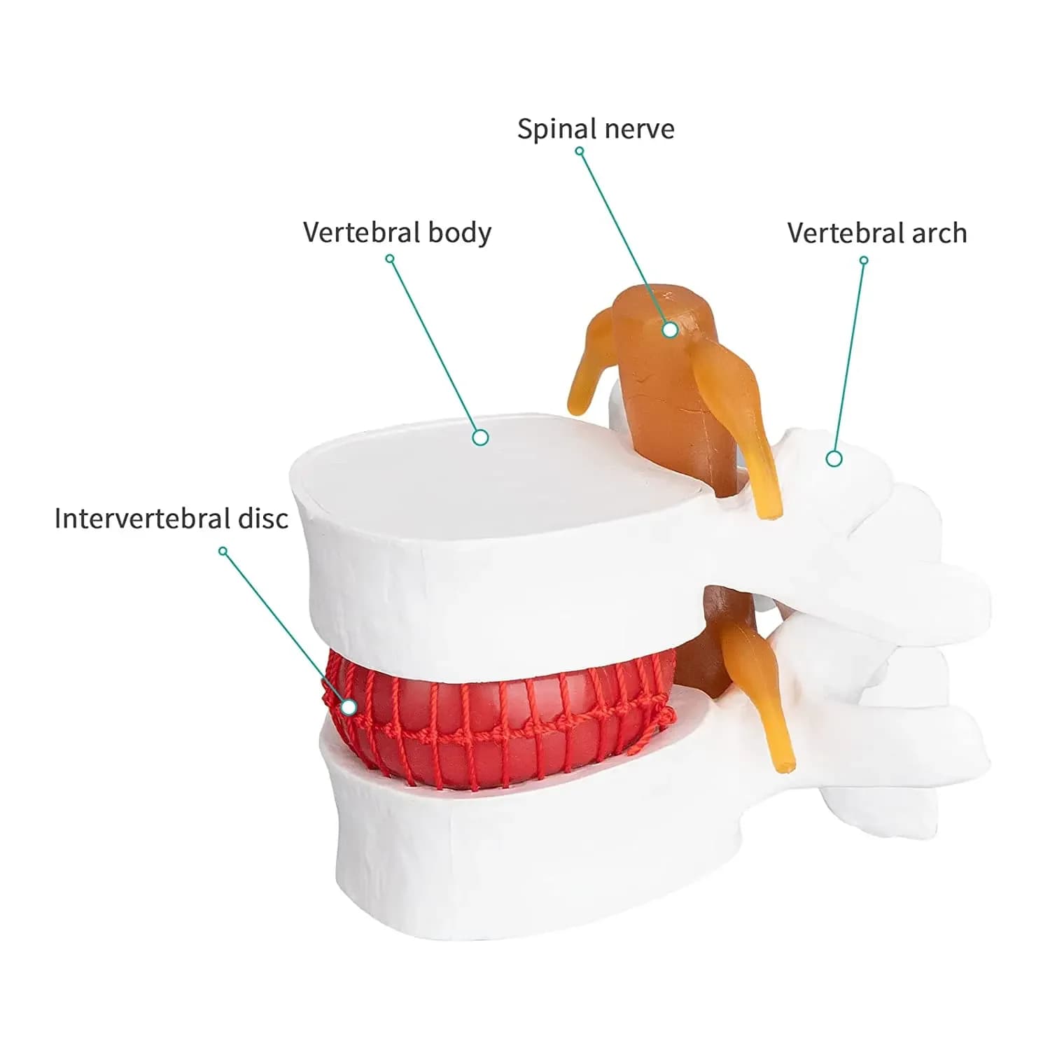 Human Lumbar Disc Herniation Spine Model 1.5X Disc Model Anatomy Vertebral Disc Model School Teaching