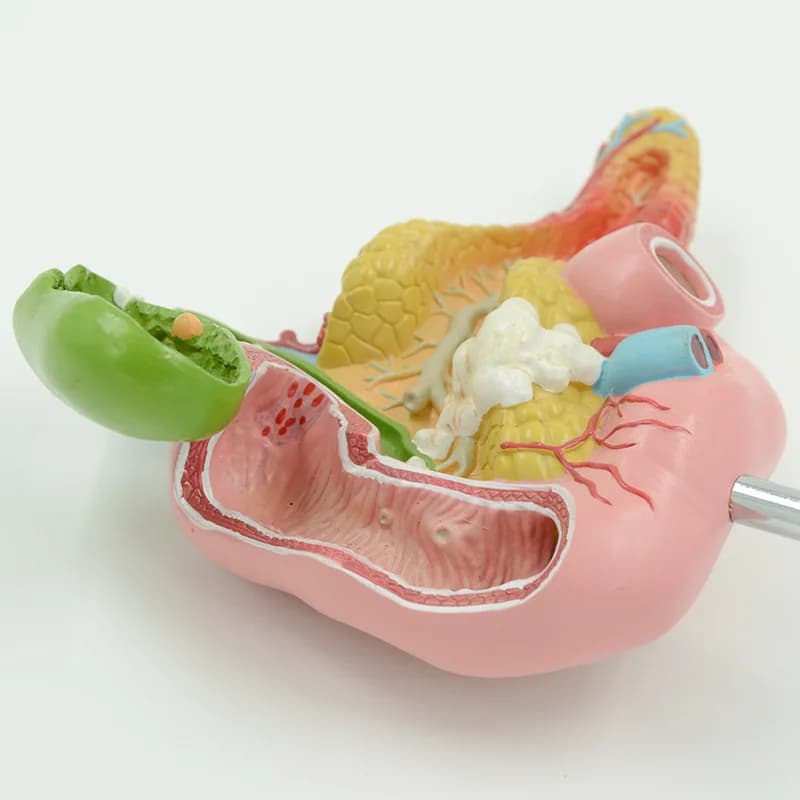 Teaching Simulation, Lesion Pancreas Spleen Hepatobiliary Duodenum Model