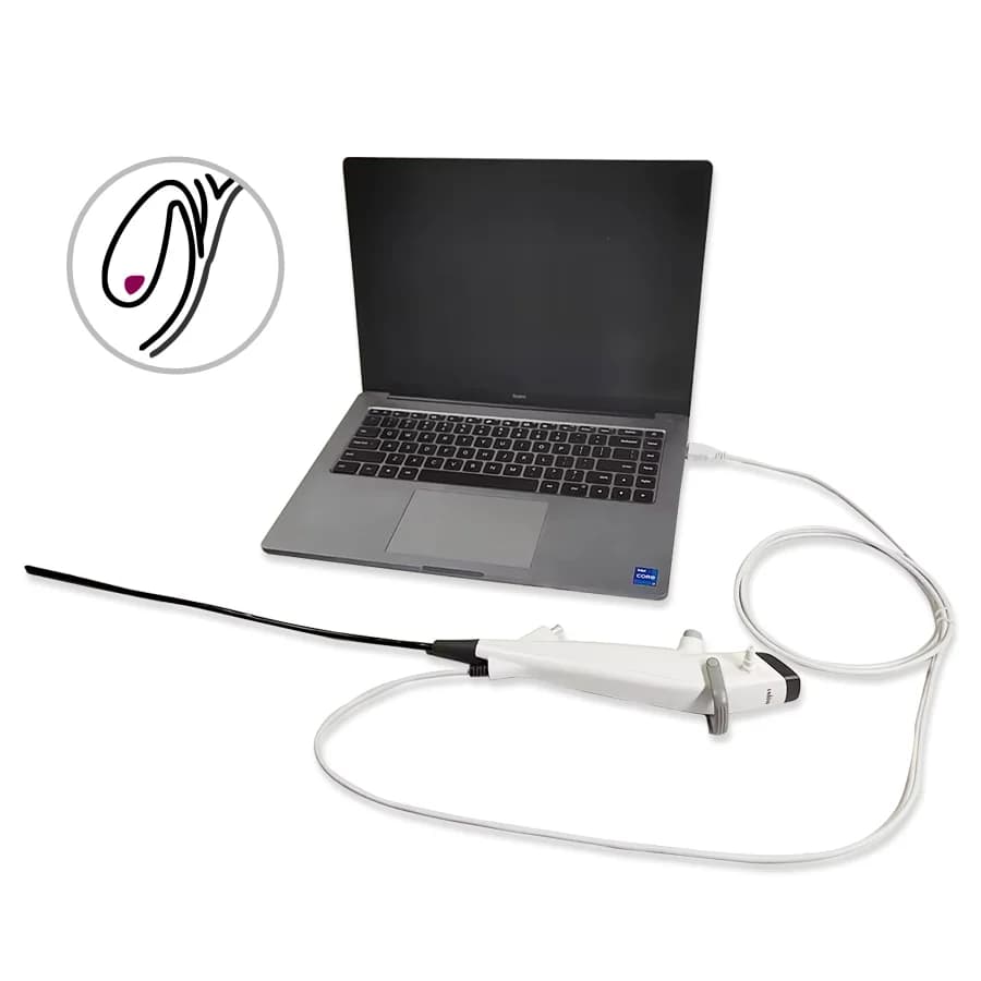 Single Use Flexible Choledochoscope High-Definition Imaging Tool for Gallstone Related Checking Tasks