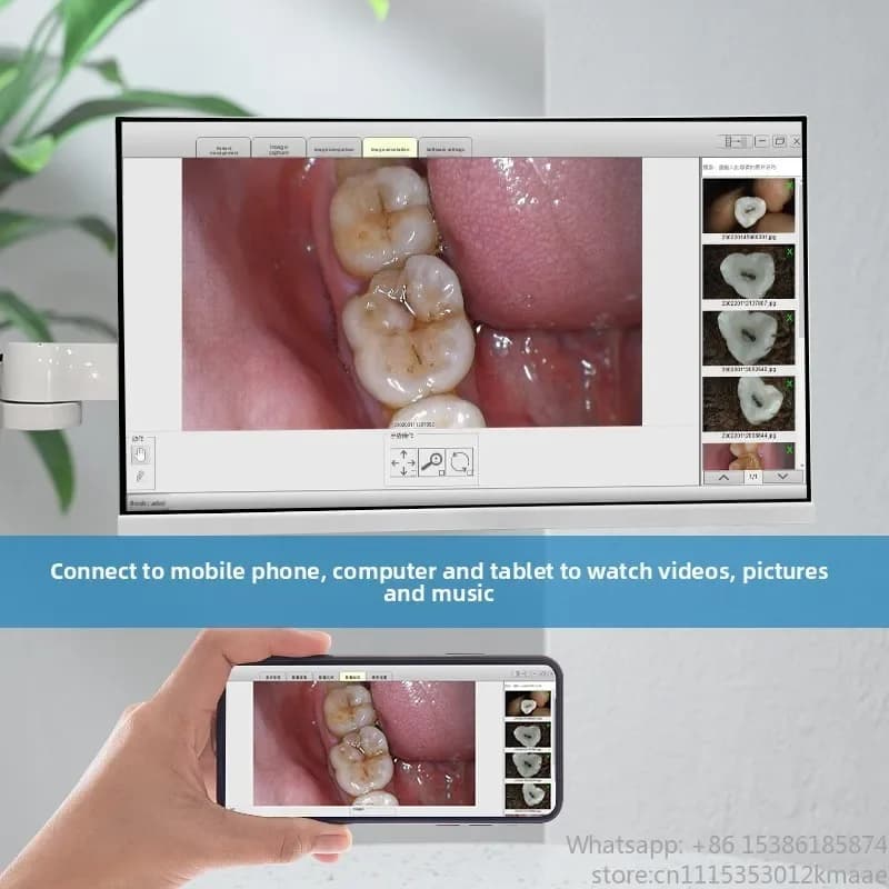 Buffalo Electric Intraoral Endoscope All-in-One 24-inch HD Touchscreen Computer for Clinics & Hospitals
