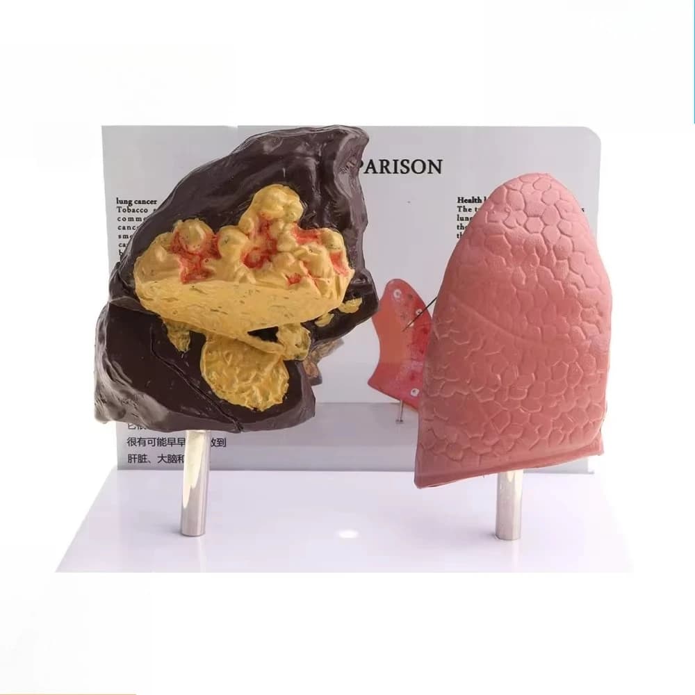 Smoking Damage Lung Model Unilateral Human Lung Anatomy Teaching Display Model