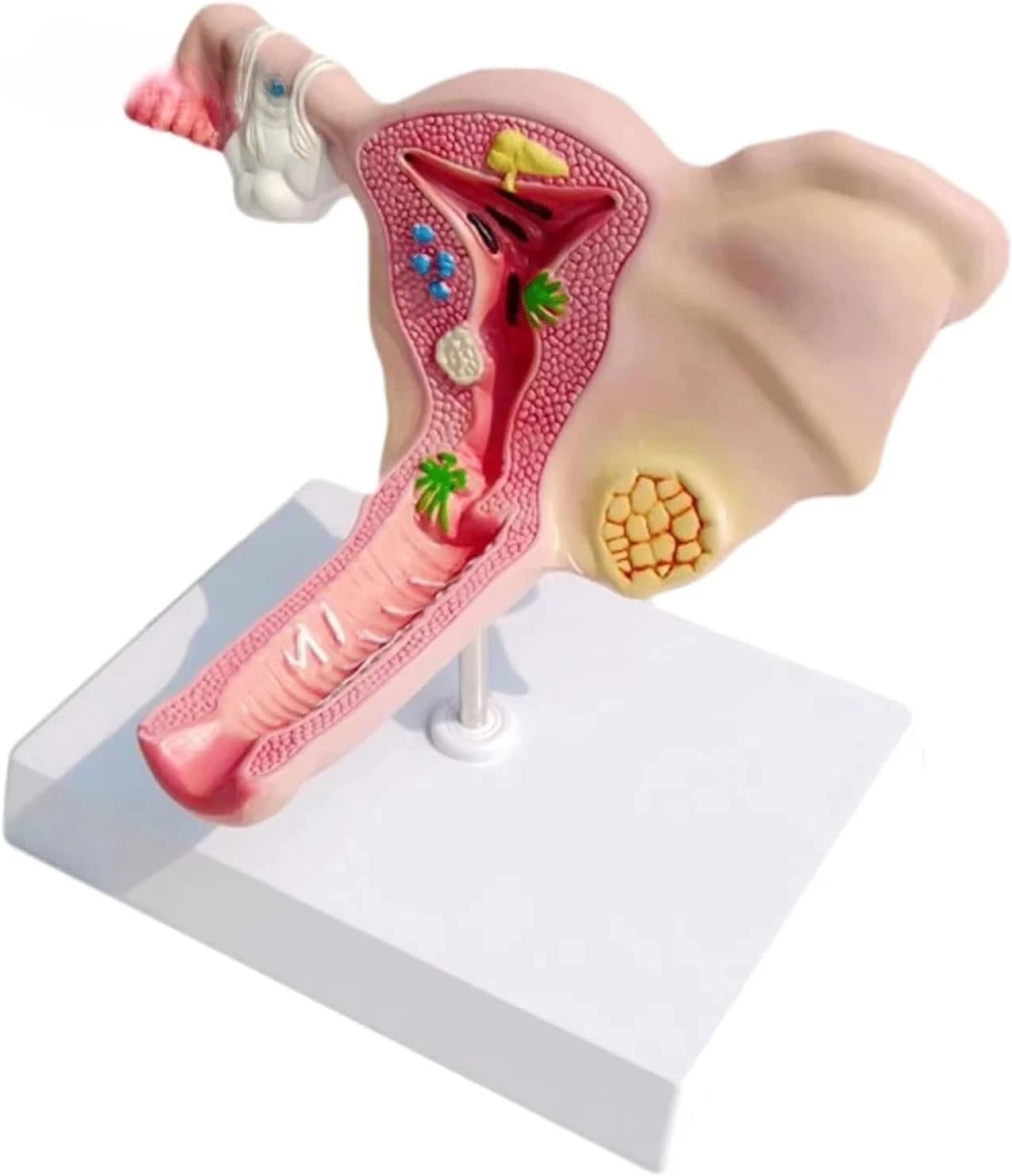 Anatomical model of the female uterus, ovaries and reproductive structure in medicine