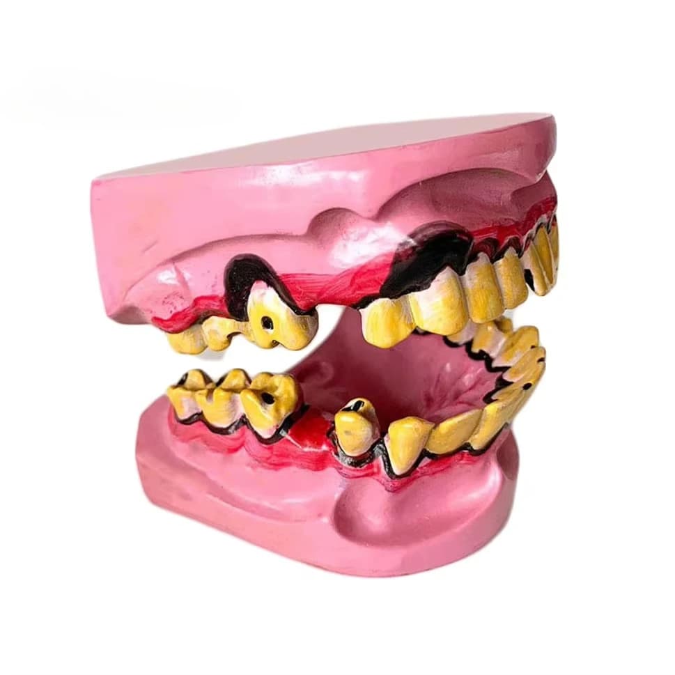 Teaching Resources Medical Education Oral Human Smokers Tooth Decay Smoking Pathological Tooth Model