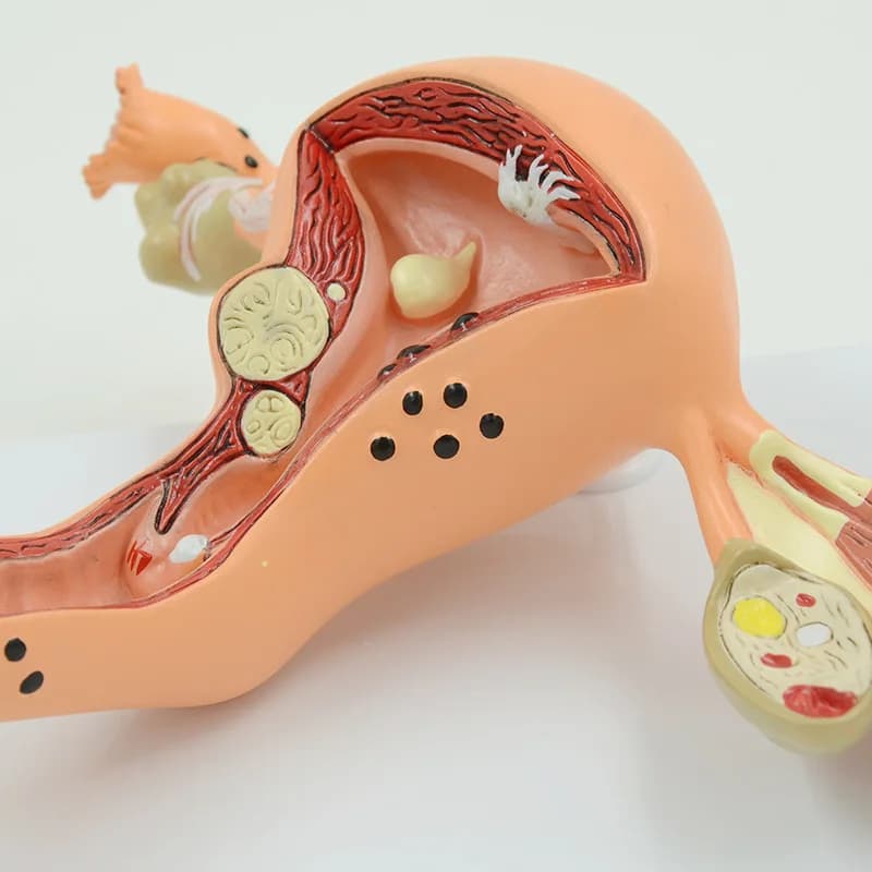 Life-size female ovarian anatomy model and pathological uterine anatomy model for medical teaching