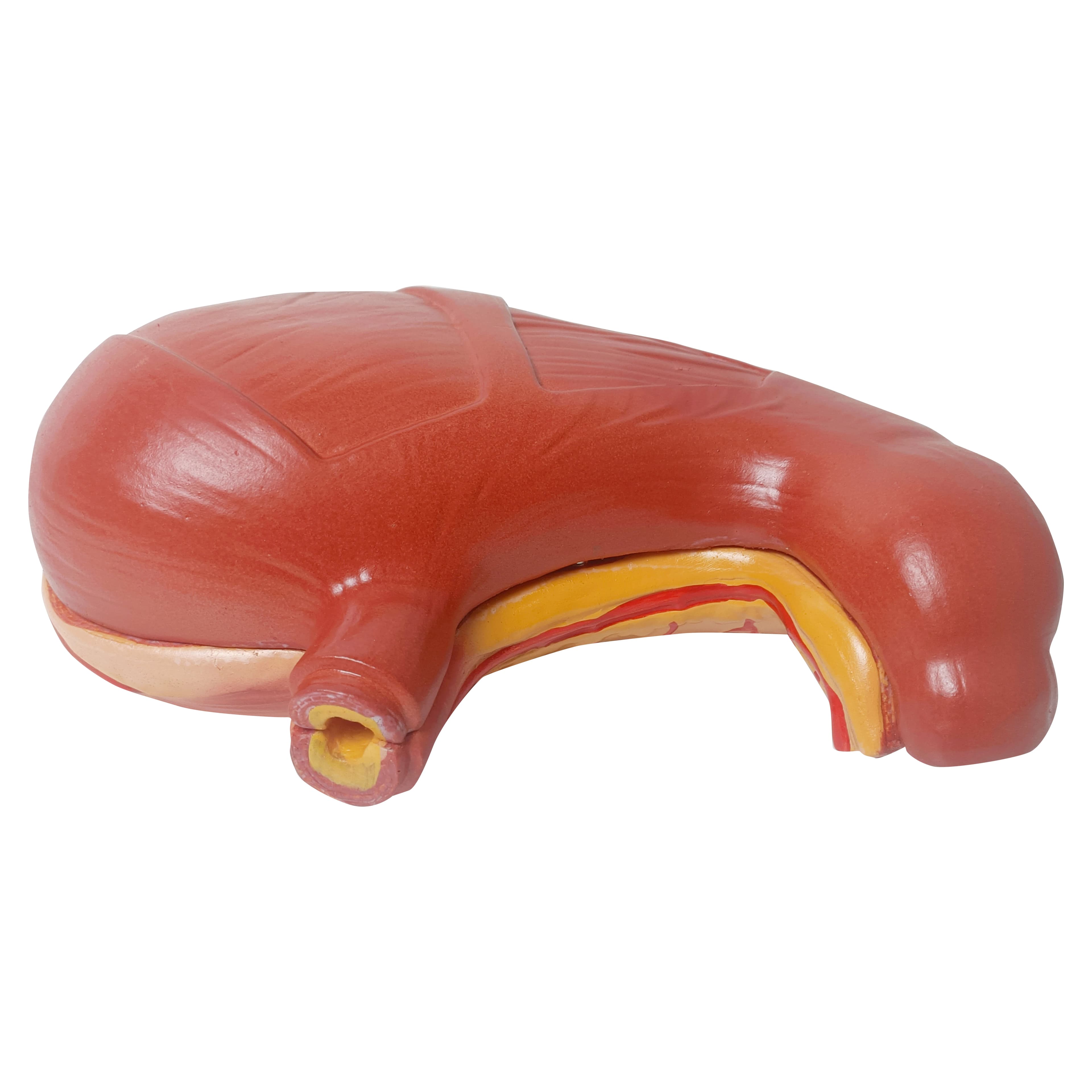Best Price Plastic Human Body Natural Size Biomedical Demonstration Teaching Anatomy Diseases Gastric Ulcer Anatomy Model