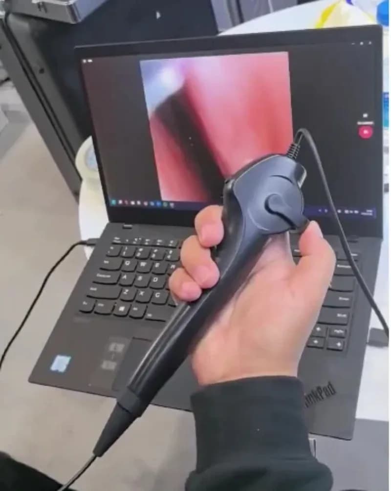 2026ENT 3,5 mm HD Rinolaringoscópio Portátil Baixo Preço Endoscopia Flexível Para  Rhinolaryngoscope