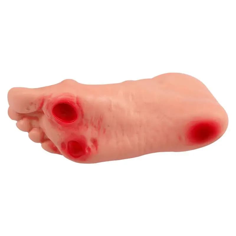 Advanced diabetic foot care model Lesion ulceration foot care training model