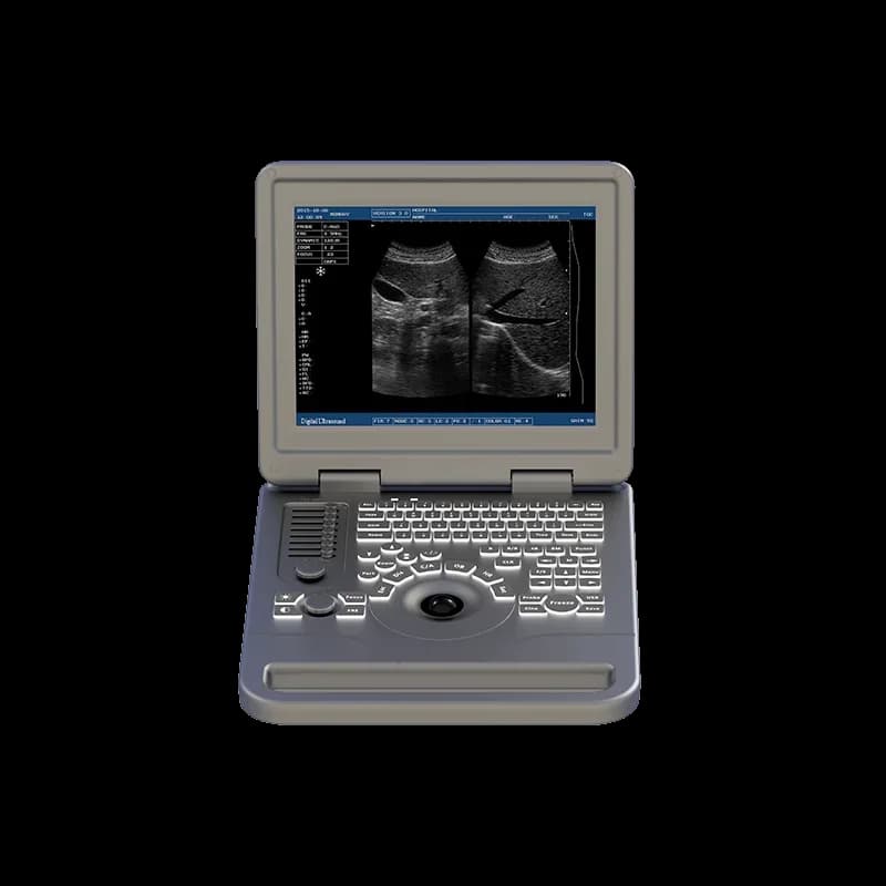 Handheld high-performance all-digital black-and-white veterinary diagnostic ultrasound machine for health monitoring