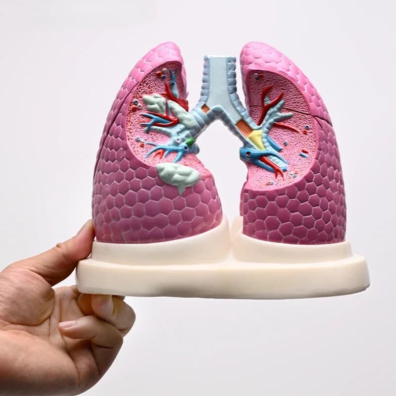 Comparative anatomical model of normal lung disease