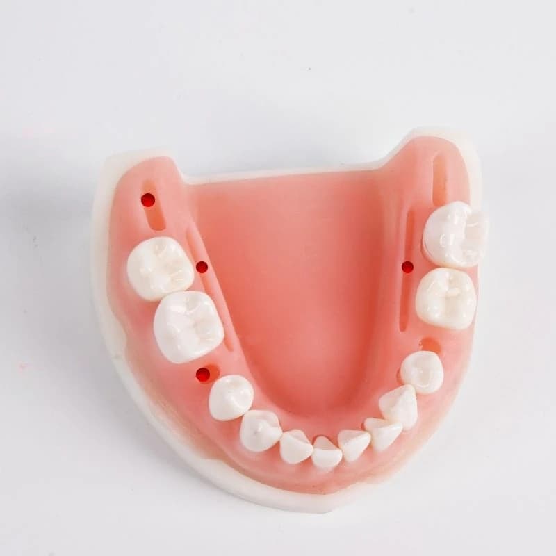 Student tooth preparation practice upper and lower jaw half mouth tooth preparation model removable teeth