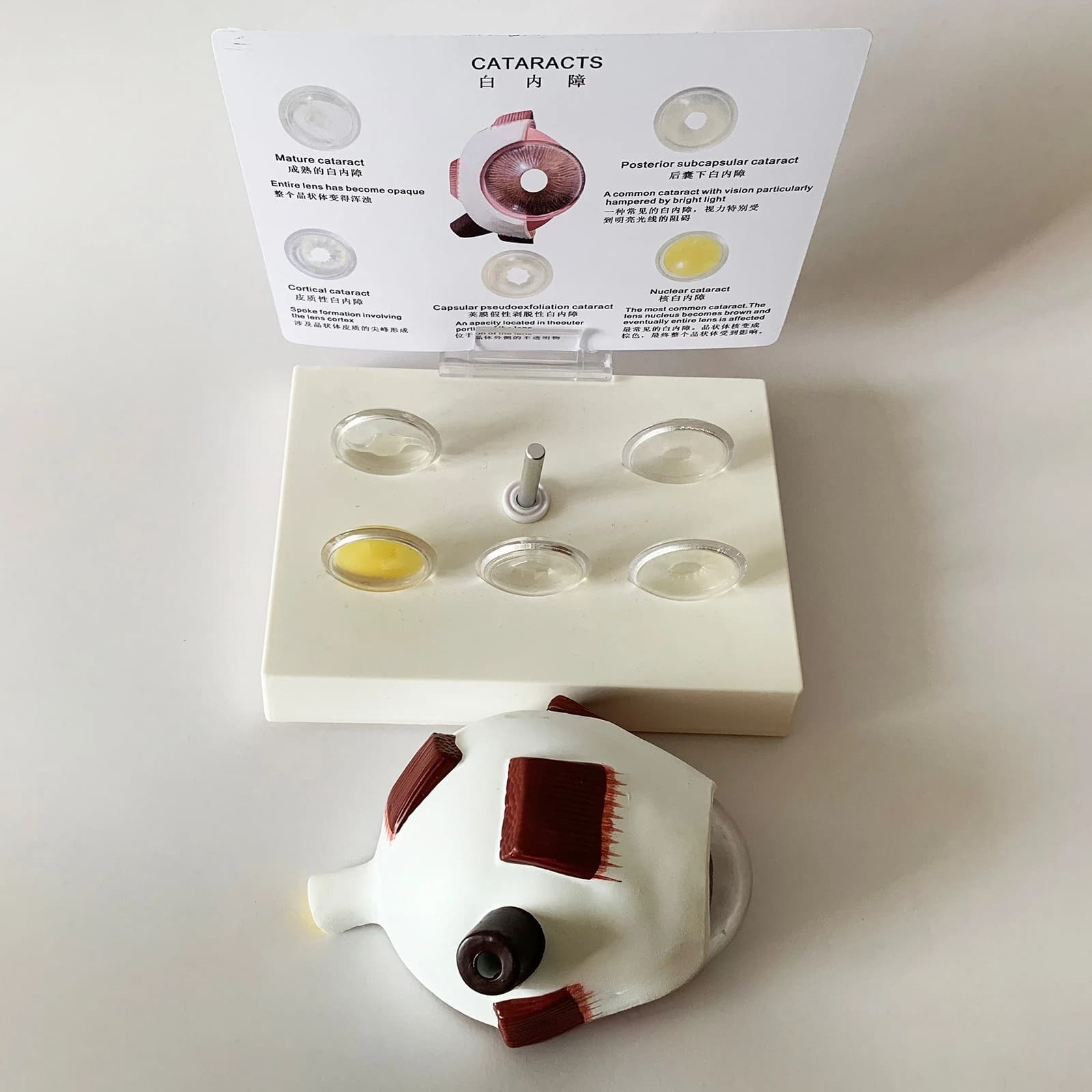 Eye anatomy model lens opacity demonstration medical teaching model
