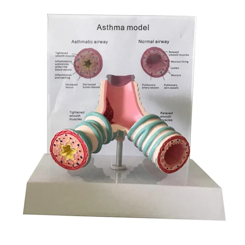 Human asthma trachea anatomy model bronchial model teaching