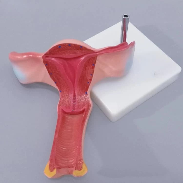 Magnified Female Uterus Ovary Model Human Reproductive Organ Anatomy Teaching Aid for Gynecology Obstetrics