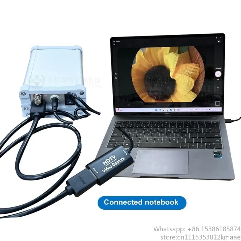 Sy-P031HD5 Full HD USB Endoscope Camera System for , ENT, PTED