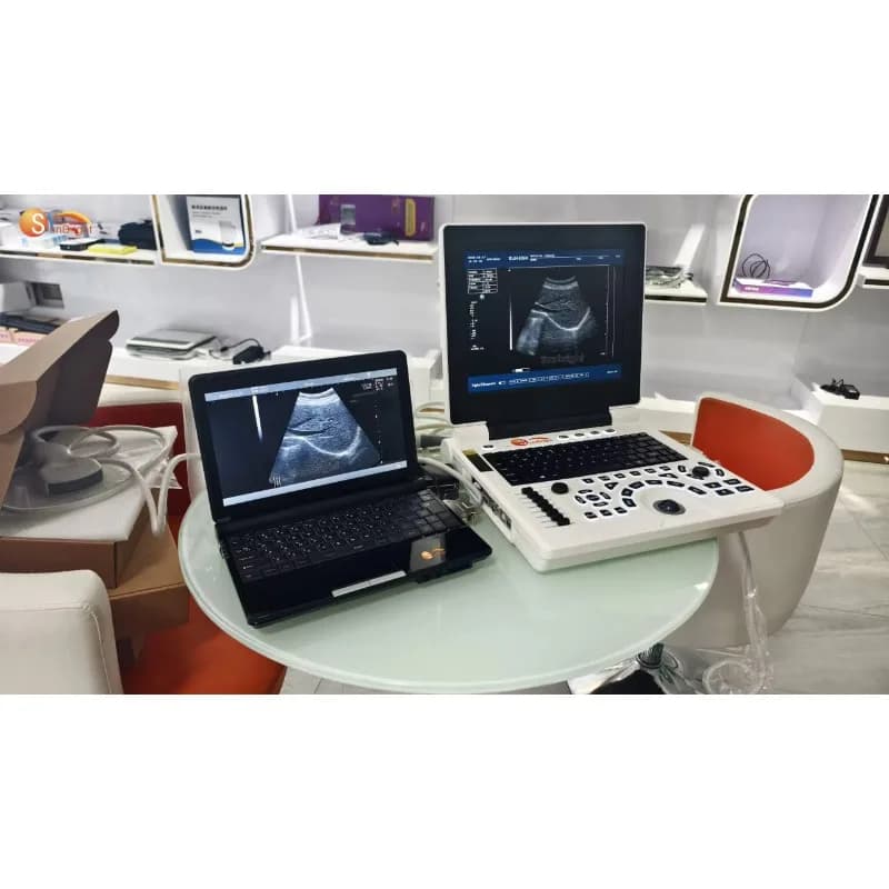 Handheld Portable Ultrasound Machine, Medical Ultrasound Scan Device, Compact Diagnostic Tool