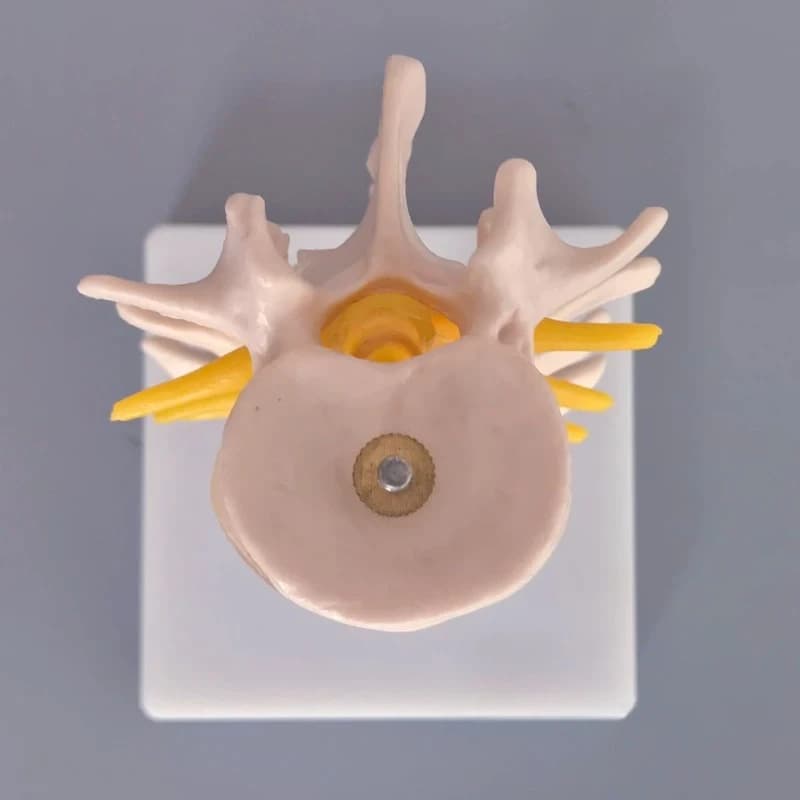 4-Segment Human Lumbar Spine Model with Intervertebral Discs and Nerves Orthopedic Anatomical Teaching Aid