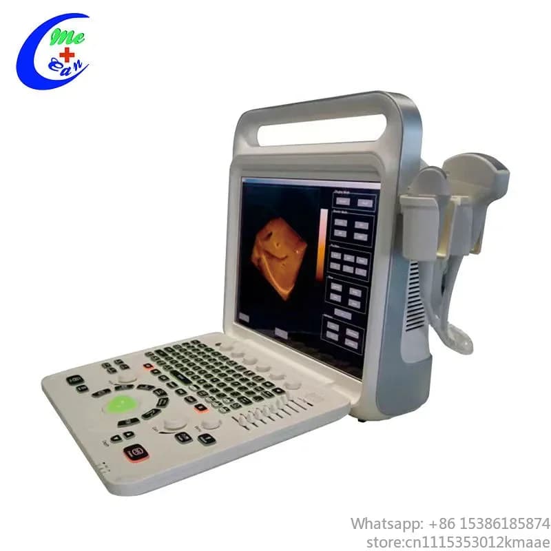 Vequyn 15-Inch Portable Machine with Multiple Probes — Hospital & Clinic Use color doppler Ultrasound