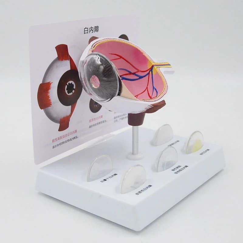 Pathological eye model Cataract eye teaching props Ophthalmic model
