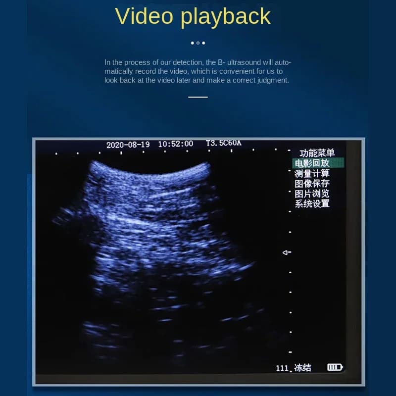 Portable 5.6 Inch Screen Veterinary Ultrasound Scanner for Cow Pig Sheep Horse - Farm Pregnancy Testing Machine