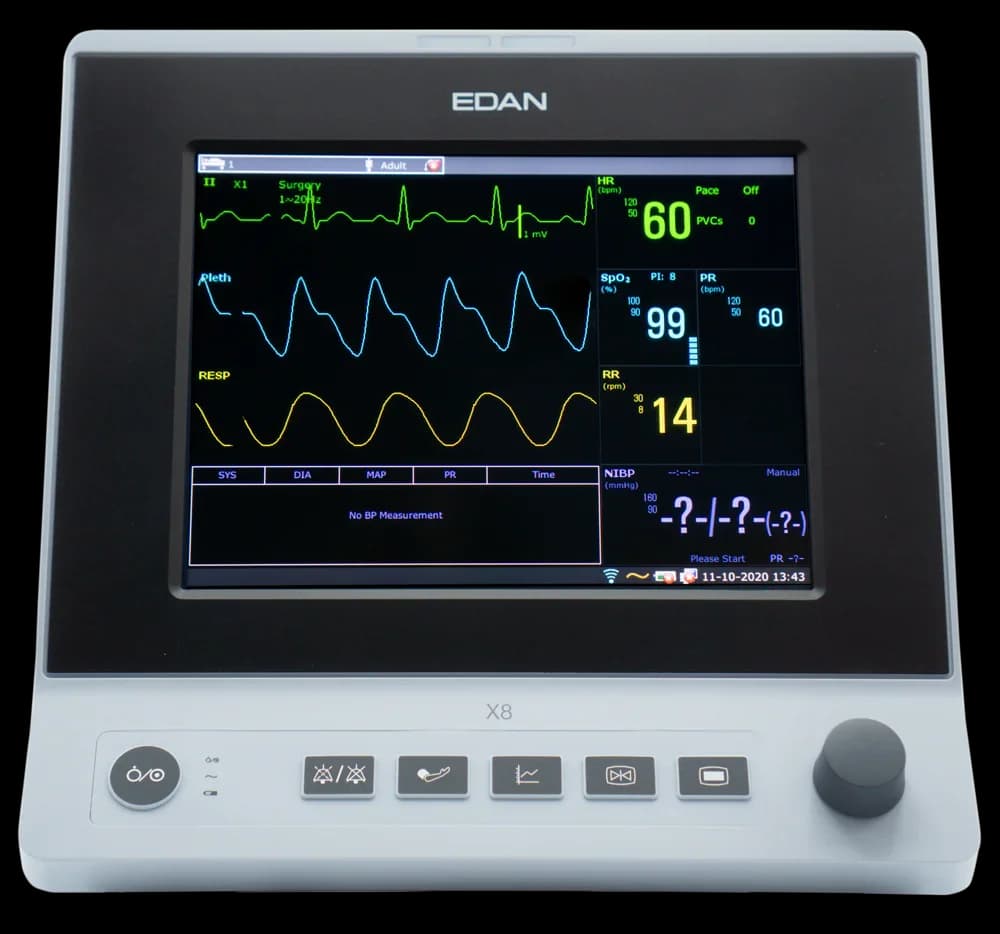 VET Compact Veterinary Patient Monitor with Touch Screen ECG SpO2 NIBP TEMP EtCO2 for Animal Hospital & Clinic