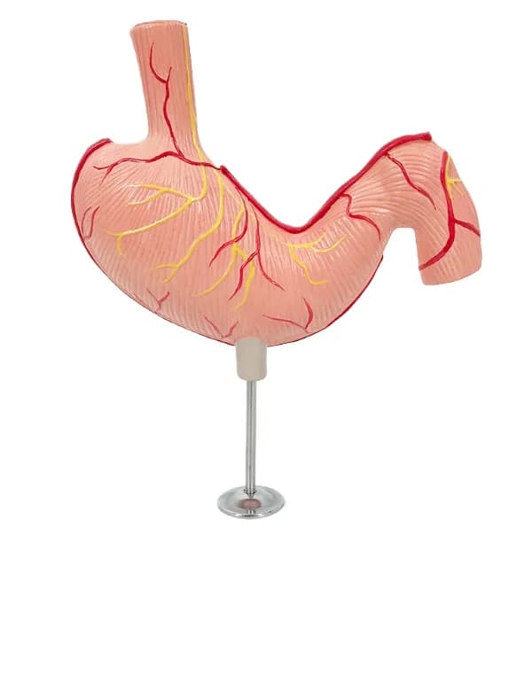High quality anatomical teaching model of gastric ulcer