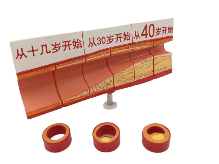 Cardiovascular Artery Anatomy Model, Thrombosis Model, Human Vascular Model