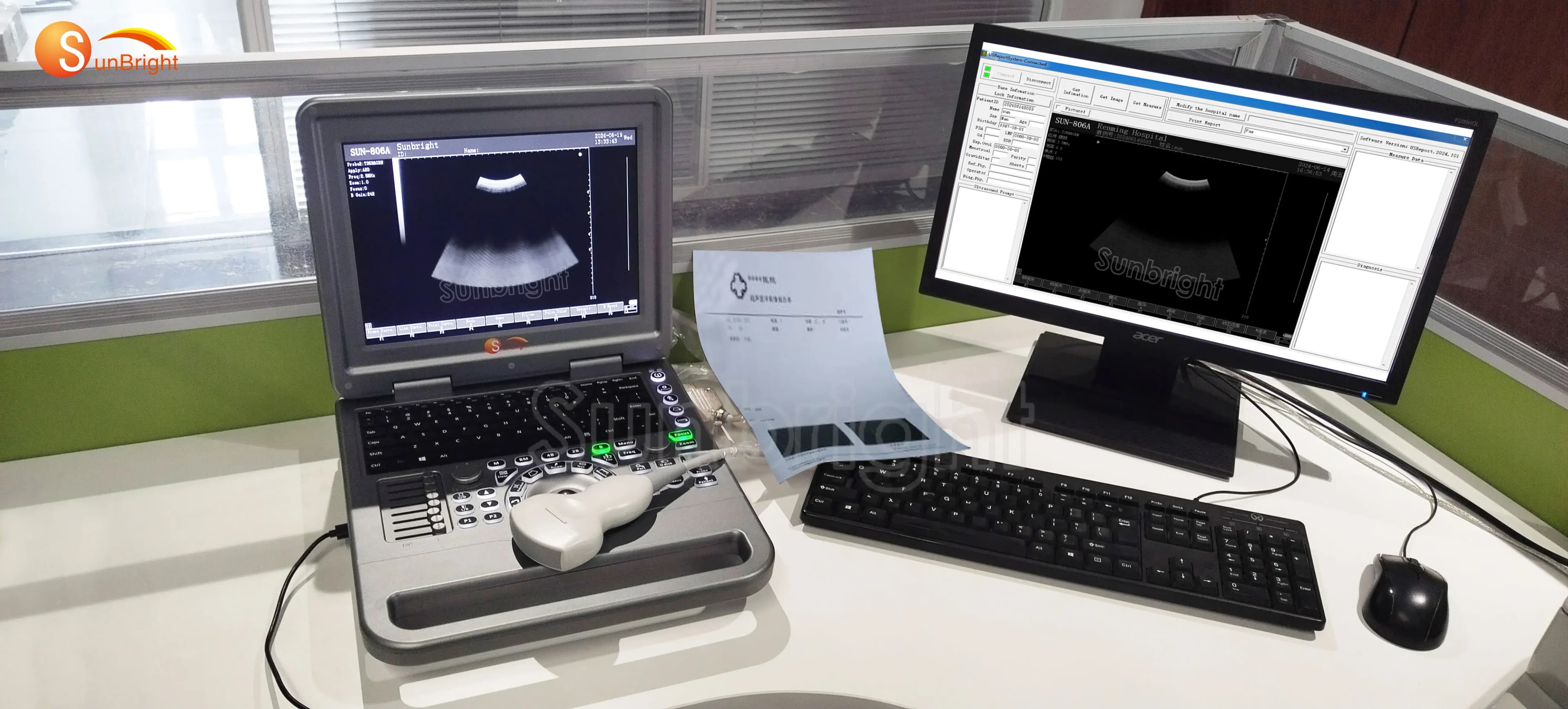 Medical BW Ultrasound Scanner Portable Ultrasonido Device for Clinical Imaging