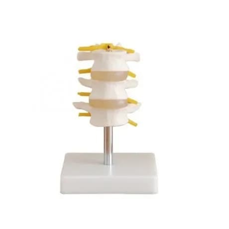 Human Spine Lumbar Skeleton Clinical Teaching Supplies, Normal Three-Section Lumbar Model