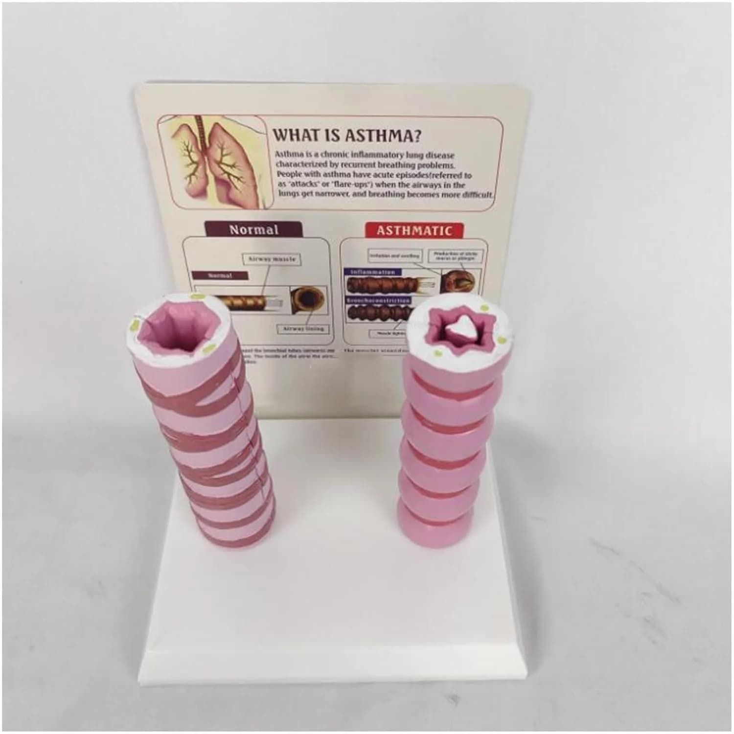 A Comparative Model of Respiratory Education between Normal and Asthma Trachea in Medical Teaching Model