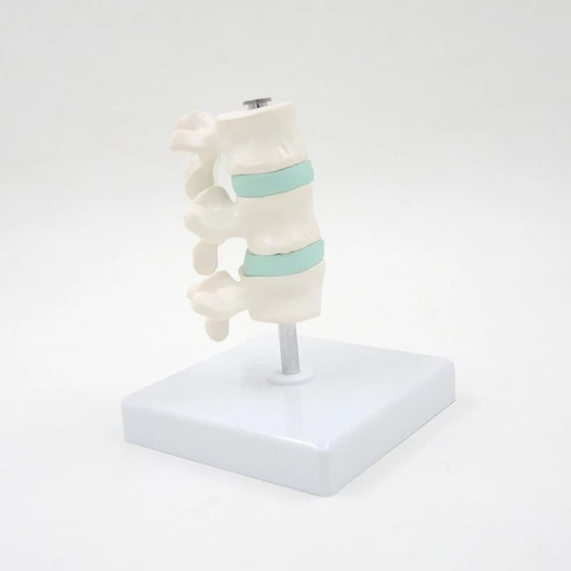 Osteoporosis disease model, spine and cervical dissection model, joint model