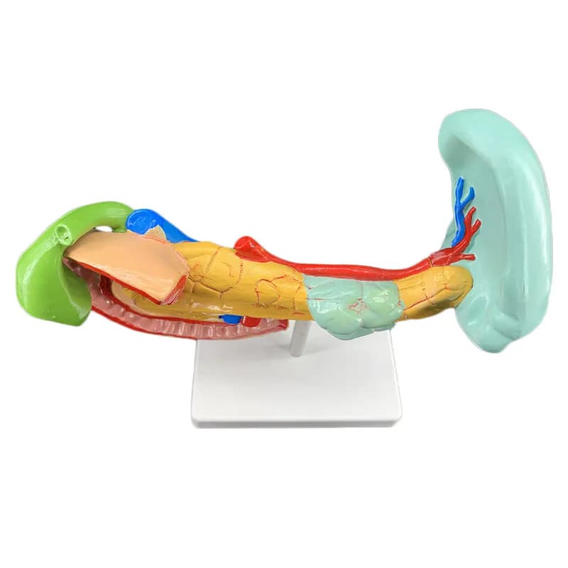 Diseased Pancreas Spleen Hepatobiliary Duodenal Anatomy Teaching Model